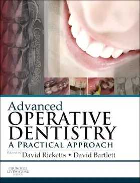 Ricketts / Bartlett |  Advanced Operative Dentistry | Buch |  Sack Fachmedien