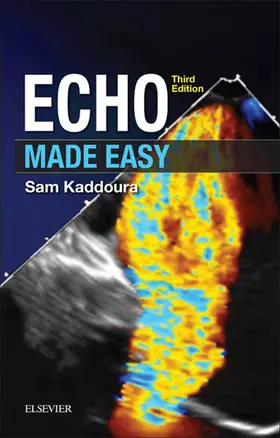 Kaddoura |  Echo Made Easy E-Book | eBook | Sack Fachmedien