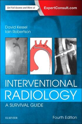 Kessel / Robertson |  Interventional Radiology: A Survival Guide | Buch |  Sack Fachmedien