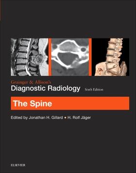 Gillard / Jager |  Grainger & Allison's Diagnostic Radiology | Buch |  Sack Fachmedien