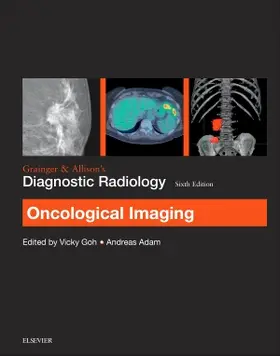 Goh / Adam |  Grainger & Allison's Diagnostic Radiology: Oncological Imaging | Buch |  Sack Fachmedien