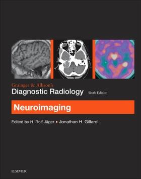 Jager / Gillard |  Grainger & Allison's Diagnostic Radiology | Buch |  Sack Fachmedien