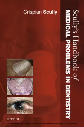 Scully |  Scully's Handbook of Medical Problems in Dentistry E-Book | eBook | Sack Fachmedien