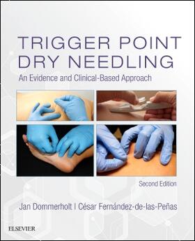 Fernandez de las Penas / Dommerholt |  Trigger Point Dry Needling | Buch |  Sack Fachmedien