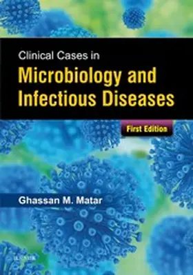 Matar |  Clinical Cases in Microbiology and Infectious Diseases E-Book | eBook | Sack Fachmedien