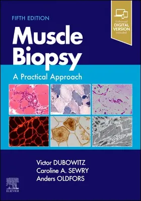 Dubowitz / Sewry / Oldfors |  Muscle Biopsy | Buch |  Sack Fachmedien