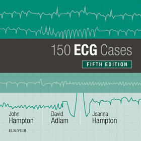 Hampton / Adlam |  150 ECG Cases | eBook | Sack Fachmedien