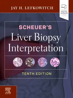 Lefkowitch | Scheuer's Liver Biopsy Interpretation | Buch | 978-0-7020-7584-1 | sack.de