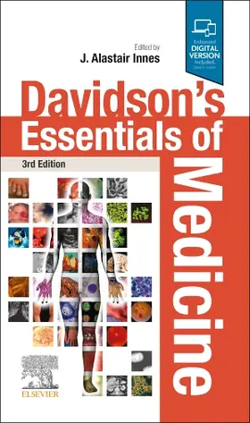 Innes |  Davidson's Essentials of Medicine | Buch |  Sack Fachmedien