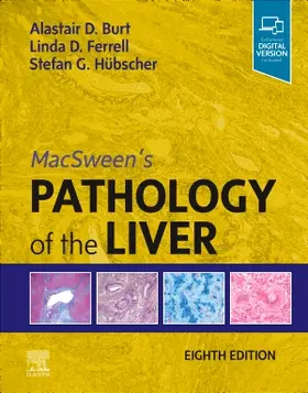 Burt / Ferrell / Hübscher |  Macsween's Pathology of the Liver | Buch |  Sack Fachmedien