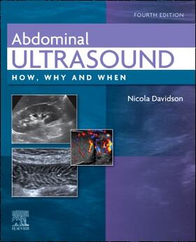 Davidson |  Abdominal Ultrasound | Buch |  Sack Fachmedien