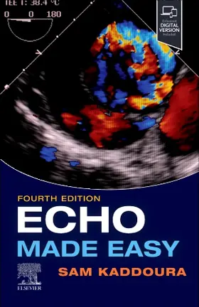 Kaddoura |  Echo Made Easy | Buch |  Sack Fachmedien