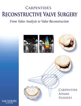 Carpentier / Adams / Filsoufi |  Carpentier's Reconstructive Valve Surgery | Buch |  Sack Fachmedien