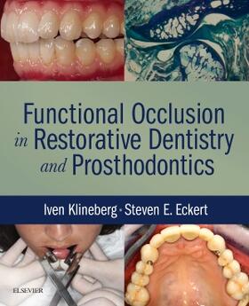 Klineberg / Eckert |  Functional Occlusion in Restorative Dentistry and Prosthodontics | Buch |  Sack Fachmedien