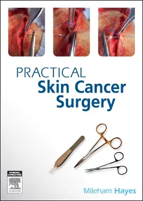 Hayes |  Practical Skin Cancer Surgery | Buch |  Sack Fachmedien