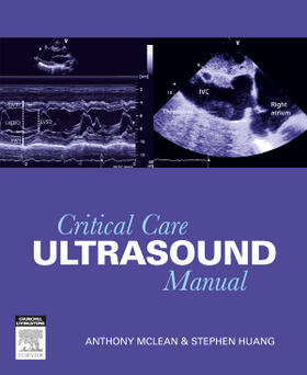 McLean / Huang |  Critical Care Ultrasound Manual | Buch |  Sack Fachmedien