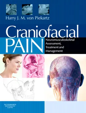 von Piekartz |  Craniofacial Pain | Buch |  Sack Fachmedien