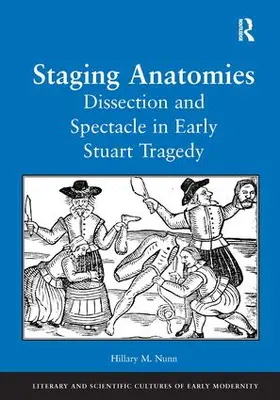 Nunn |  Staging Anatomies | Buch |  Sack Fachmedien