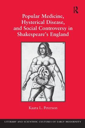 Peterson |  Popular Medicine, Hysterical Disease, and Social Controversy in Shakespeare's England | Buch |  Sack Fachmedien