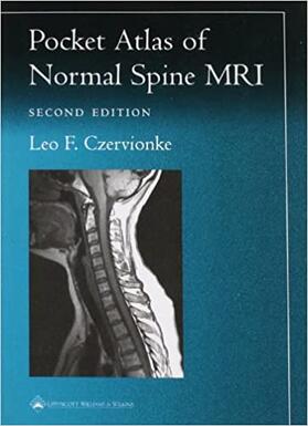Czervionke |  Pocket Atlas of Spinal MRI | Buch |  Sack Fachmedien