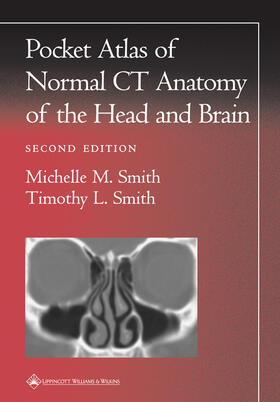 Smith | Pocket Atlas of Normal CT Anatomy of the Head and Brain | Buch | 978-0-7817-2949-9 | sack.de