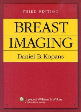 Kopans |  Breast Imaging | Buch |  Sack Fachmedien