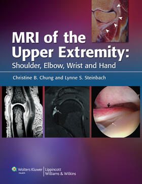 Steinbach / Chung / Brown |  MRI of the Upper Extremity | Buch |  Sack Fachmedien