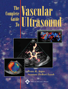 Arger / DeBari Iyoob |  The Complete Guide to Vascular Ultrasound | Buch |  Sack Fachmedien