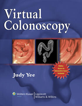 Yee | Virtual Colonoscopy | Buch | 978-0-7817-5770-6 | sack.de