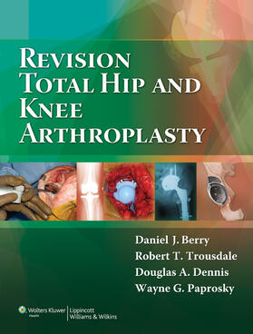 Berry / Trousdale / Dennis |  Revision Total Hip and Knee Arthroplasty | Buch |  Sack Fachmedien