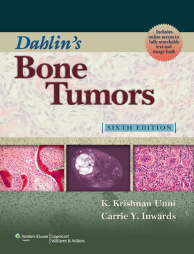 Unni / Inwards |  Dahlin's Bone Tumors: General Aspects and Data on 10,165 Cases | Buch |  Sack Fachmedien