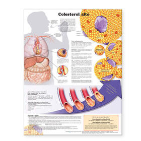 High Cholesterol Anatomical Chart in Spanish (Colesterol alto) | Sonstiges | 978-0-7817-7304-1 | sack.de