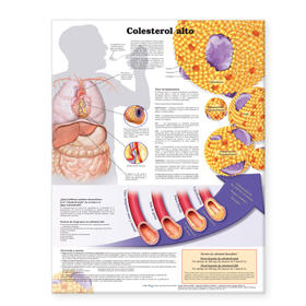 High Cholesterol Anatomical Chart in Spanish (Colesterol alto) | Sonstiges | 978-0-7817-7305-8 | sack.de