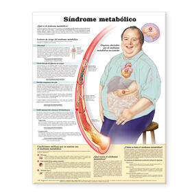  Metabolic Syndrome Anatomical Chart in Spanish (Síndrome metabólico) | Sonstiges |  Sack Fachmedien