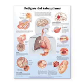 Dangers of Smoking Anatomical Chart in Spanish (Peligros del tabaquismo) | Sonstiges | 978-0-7817-7317-1 | sack.de