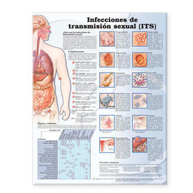 Sexually Transmitted Infections Anatomical Chart in Spanish (Infecciones de transmisión sexual) | Sonstiges | 978-0-7817-7341-6 | sack.de