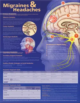  Migraines and Headaches Anatomical Chart | Sonstiges |  Sack Fachmedien