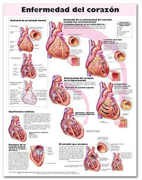 Heart Disease Anatomical Chart in Spanish (Enfermedad del corazón) | Sonstiges | 978-0-7817-8219-7 | sack.de