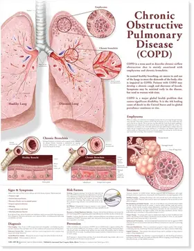  Chronic Obstructive Pulmonary Disease Anatomical Chart | Sonstiges |  Sack Fachmedien