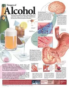  Dangers of Alcohol Anatomical Chart | Sonstiges |  Sack Fachmedien