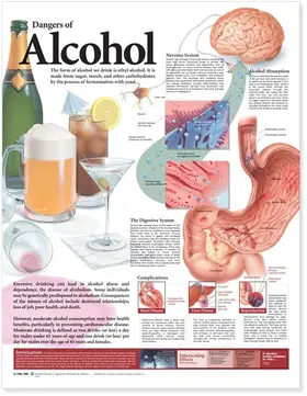  Dangers of Alcohol Anatomical Chart | Sonstiges |  Sack Fachmedien