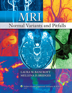 Bancroft / Bridges | MRI Normal Variants and Pitfalls | Buch | 978-0-7817-8314-9 | sack.de