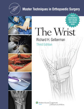 Gelberman |  Master Techniques in Orthopaedic Surgery: The Wrist | Buch |  Sack Fachmedien