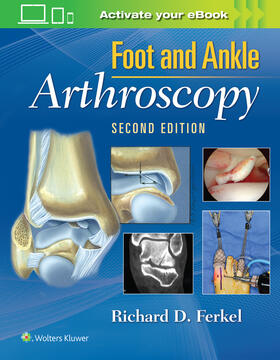 Ferkel |  Foot & Ankle Arthroscopy | Buch |  Sack Fachmedien