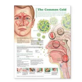  Understanding the Common Cold Anatomical Chart | Sonstiges |  Sack Fachmedien