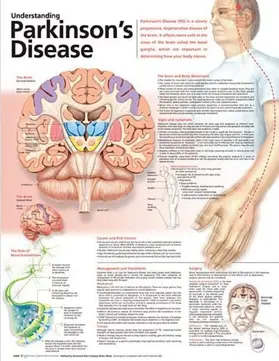  Understanding Parkinson's Disease Anatomical Chart | Sonstiges |  Sack Fachmedien