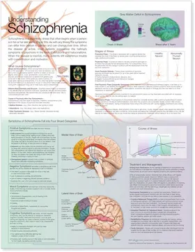  Understanding Schizophrenia Anatomical Chart | Sonstiges |  Sack Fachmedien