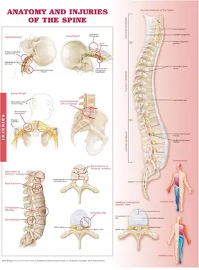  Anatomy and Injuries of the Spine: Anatomical Chart | Sonstiges |  Sack Fachmedien