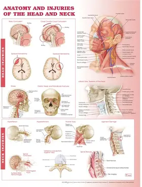  Anatomy and Injuries of the Head and Neck Anatomical Chart | Sonstiges |  Sack Fachmedien