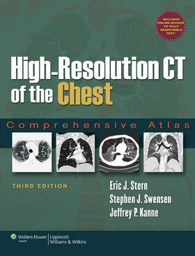 Stern / Swensen / Kanne |  High-Resolution CT of the Chest | Buch |  Sack Fachmedien
